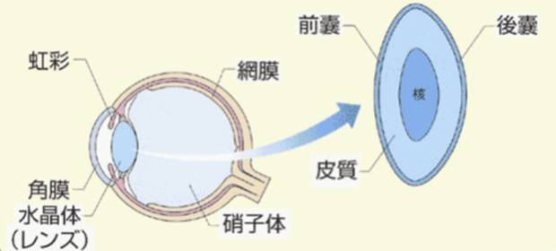 白内障とは 八千代市 眼科 加藤眼科 日帰り白内障手術 緑内障